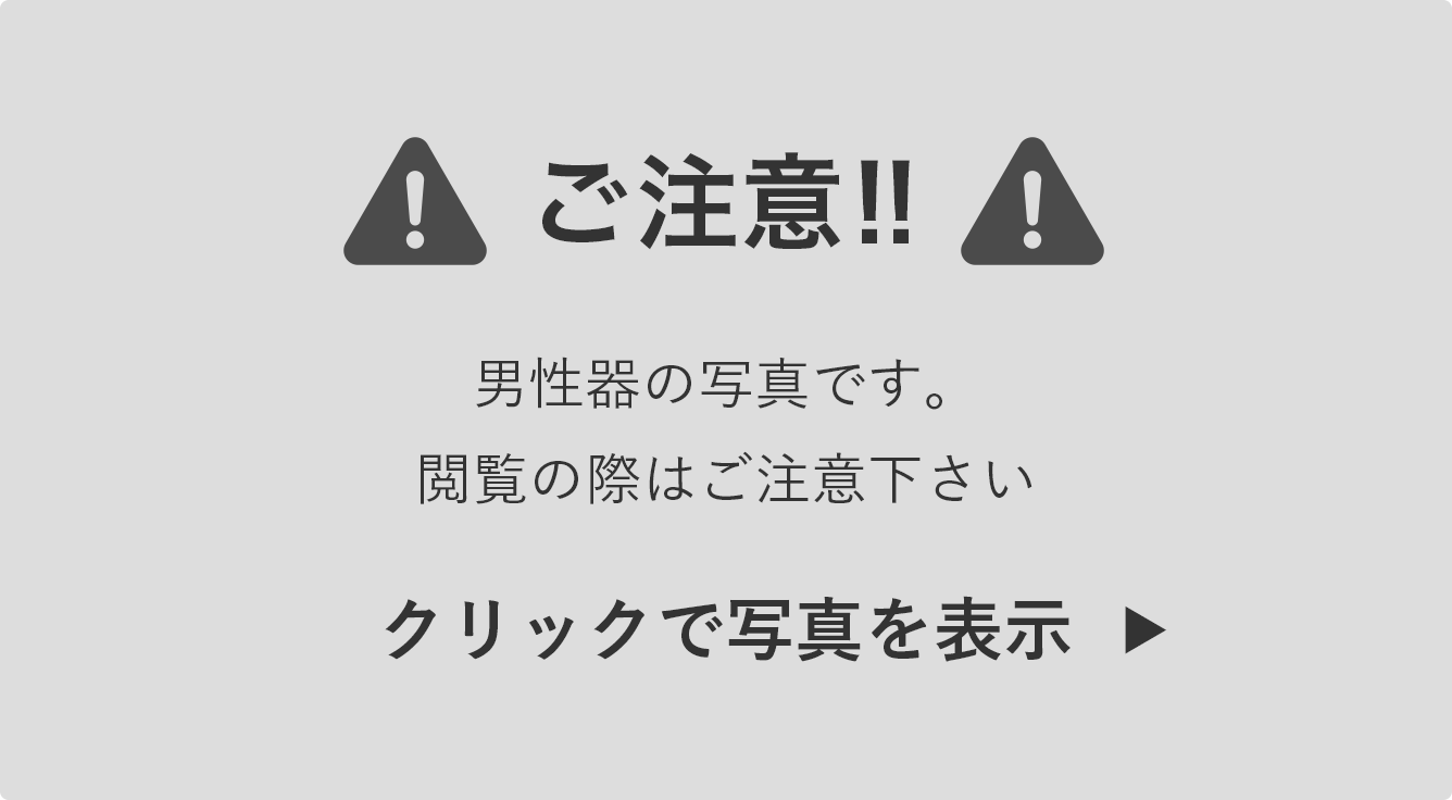 嵌頓包茎はどのように治療されますか?