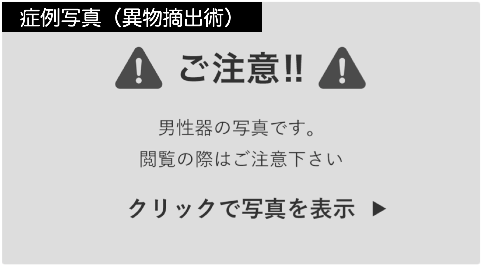 手順はどのように機能しますか?