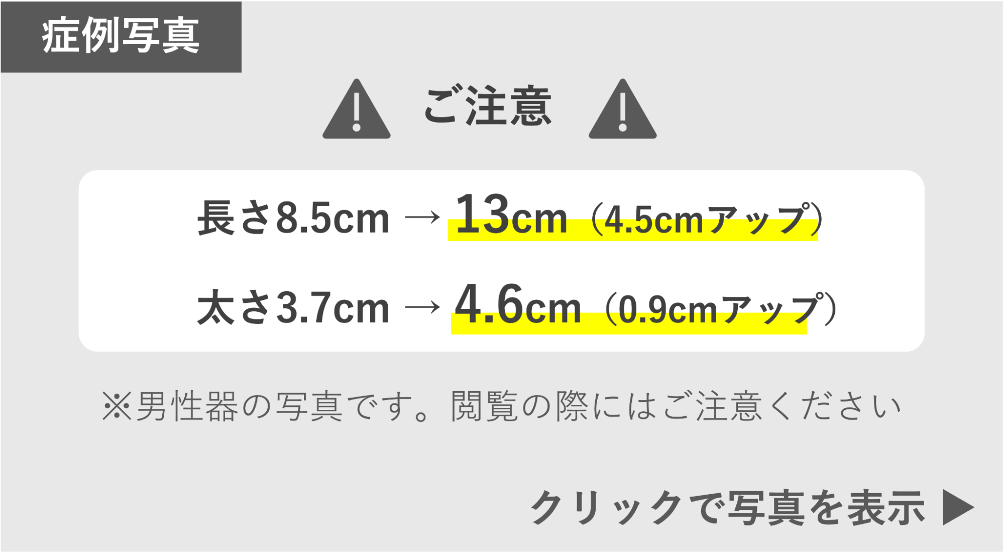 グランセンサー解除法によってサイズアップ（4.5cm）した症例 症例写真閲覧の警告