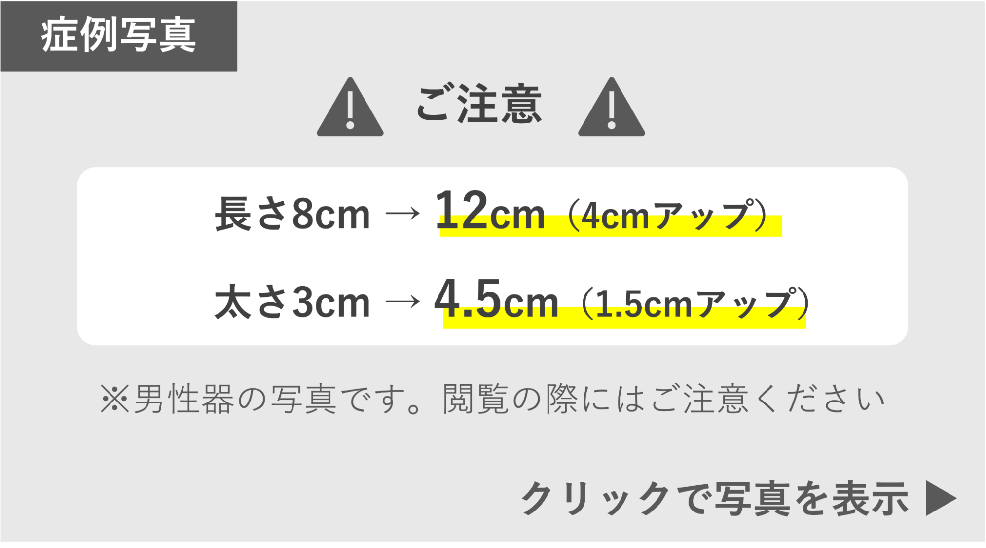 長茎手術によってサイズアップ（4cm）の症例 症例写真閲覧の警告