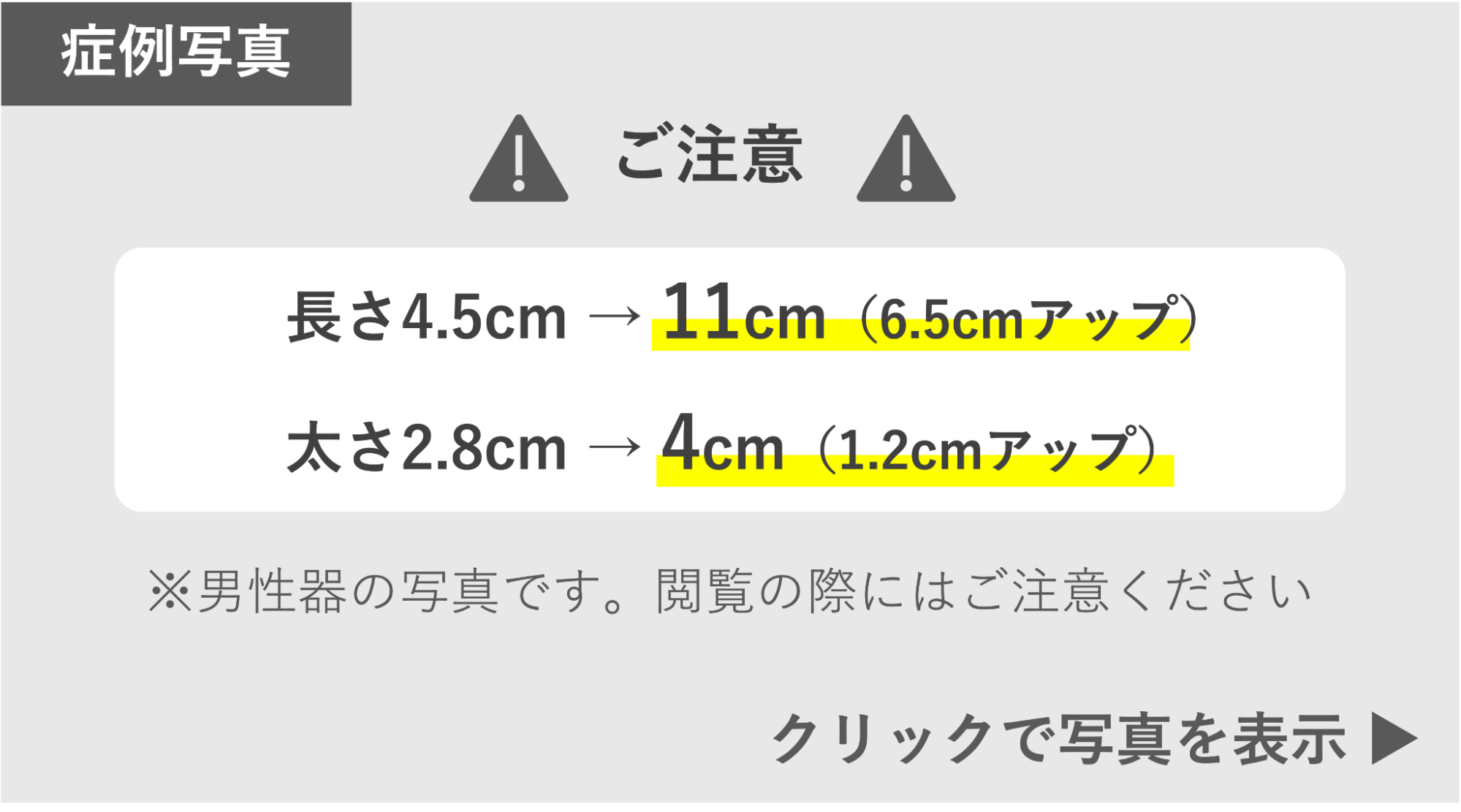 長茎手術によってサイズアップ（6.5cm）の症例 症例写真閲覧の警告