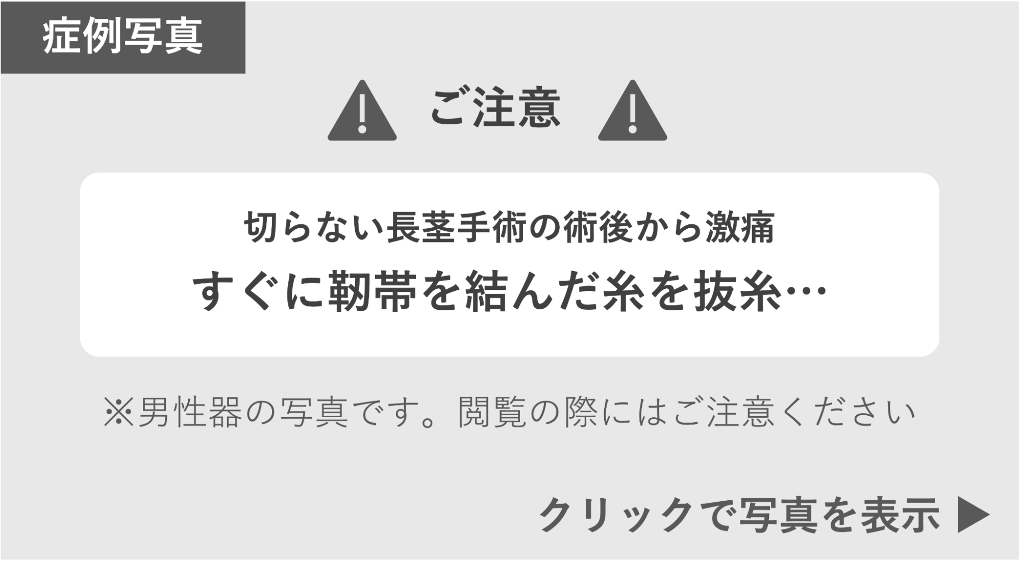 切らない長茎手術で激痛 症例写真閲覧の警告