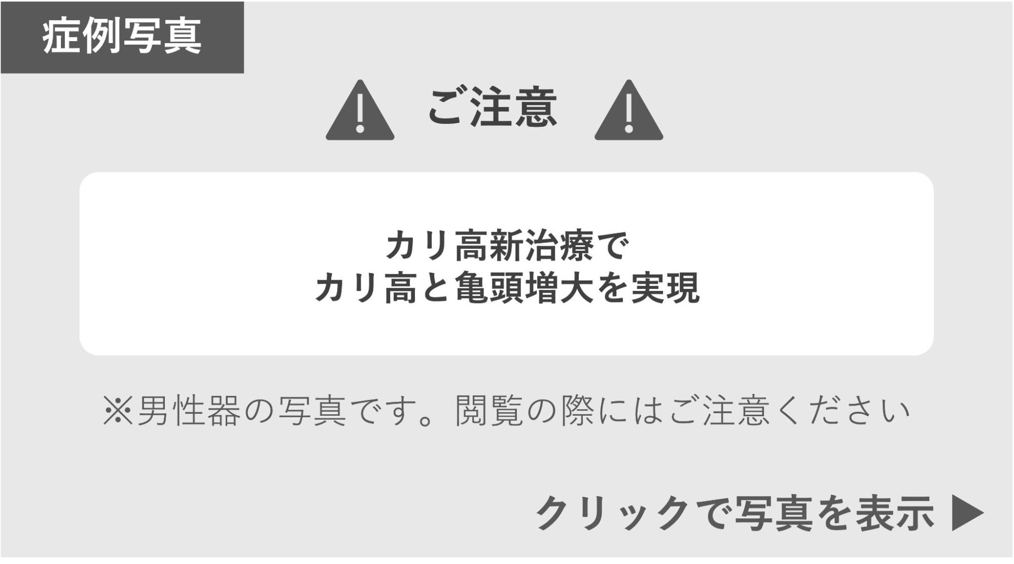 カリ高新治療を受けたペニスの症例写真 症例写真閲覧の警告