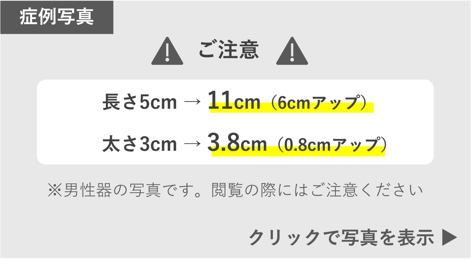 長茎手術によってサイズアップ（6cm）の症例 症例写真閲覧の警告