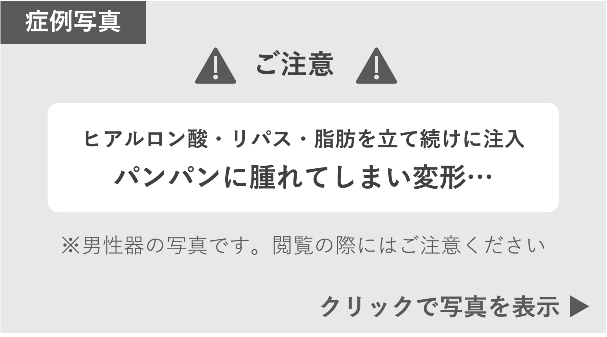 注入を続け変形してしまったペニスの症例写真 症例写真閲覧の警告
