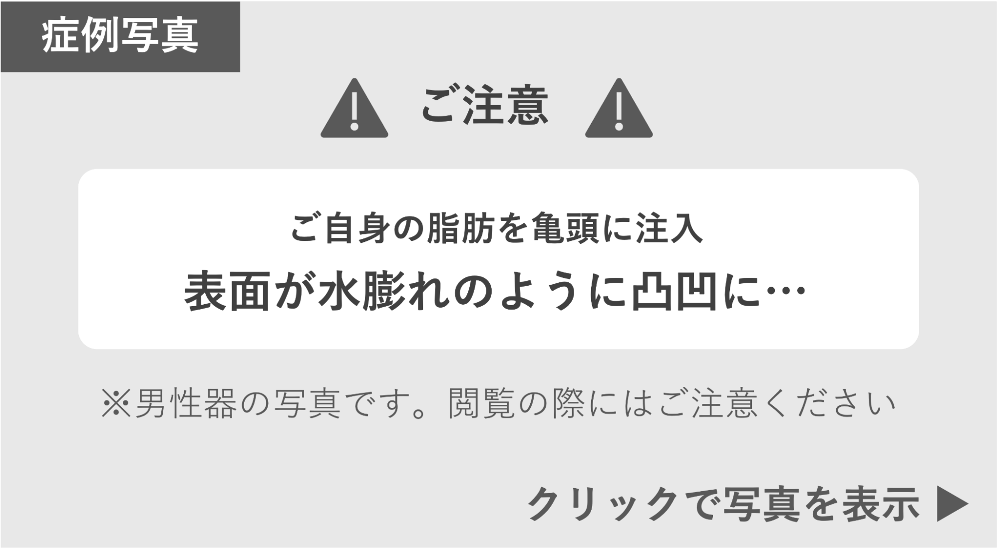 脂肪注入によって表面が水膨れのようになったペニスの症例写真 症例写真閲覧の警告
