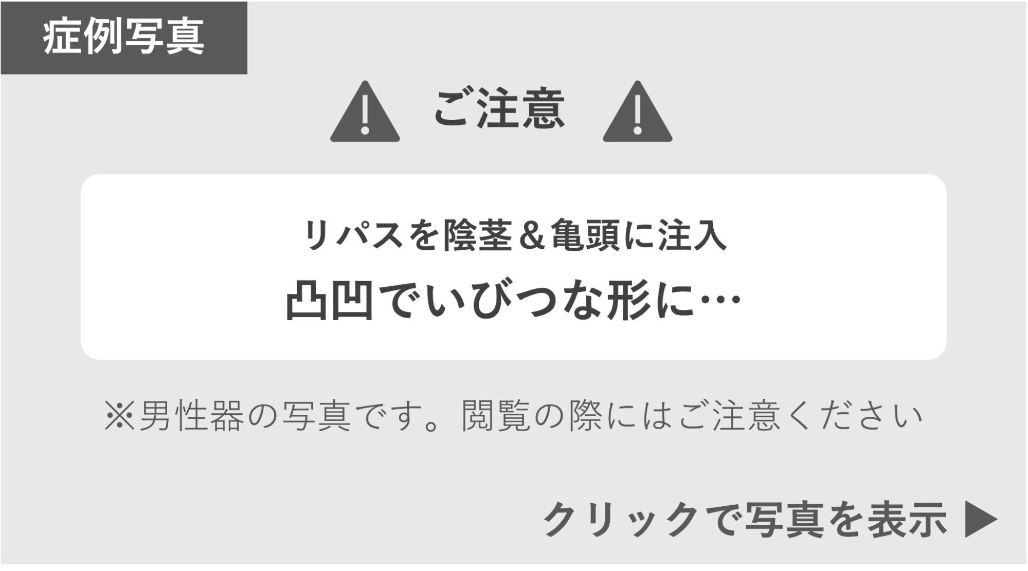 リパスの影響でいびつな形になったペニスの症例写真 症例写真閲覧の警告