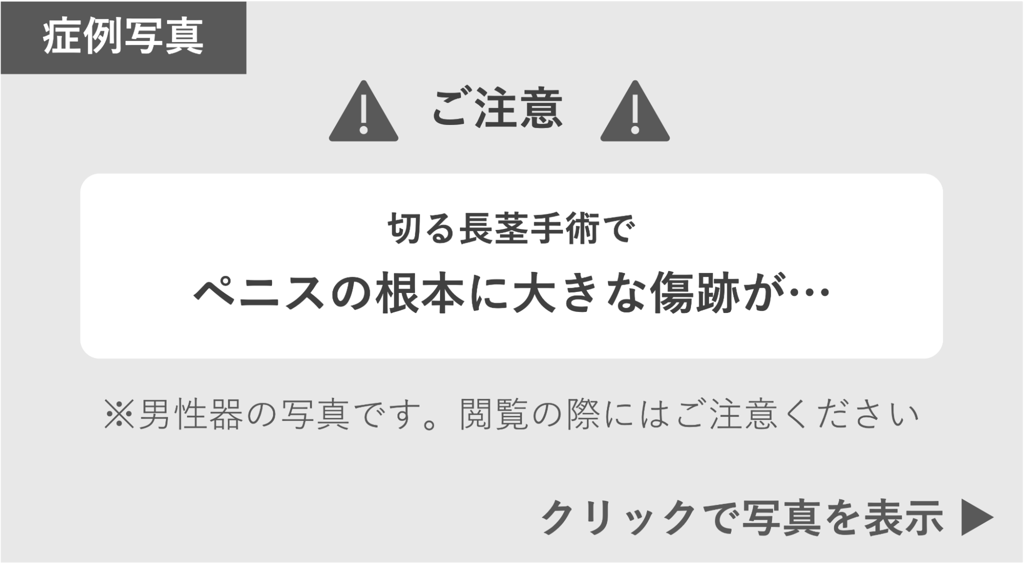 切る長茎手術によって根元に大きな傷跡 症例写真閲覧の警告