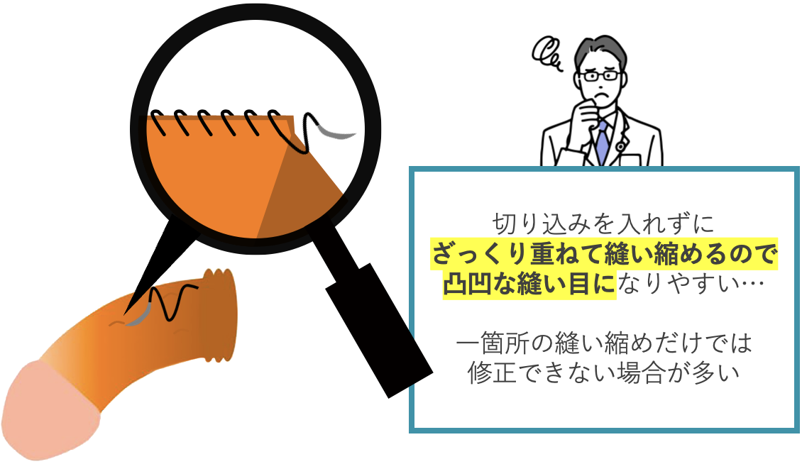 プリケーション法の手術イメージ