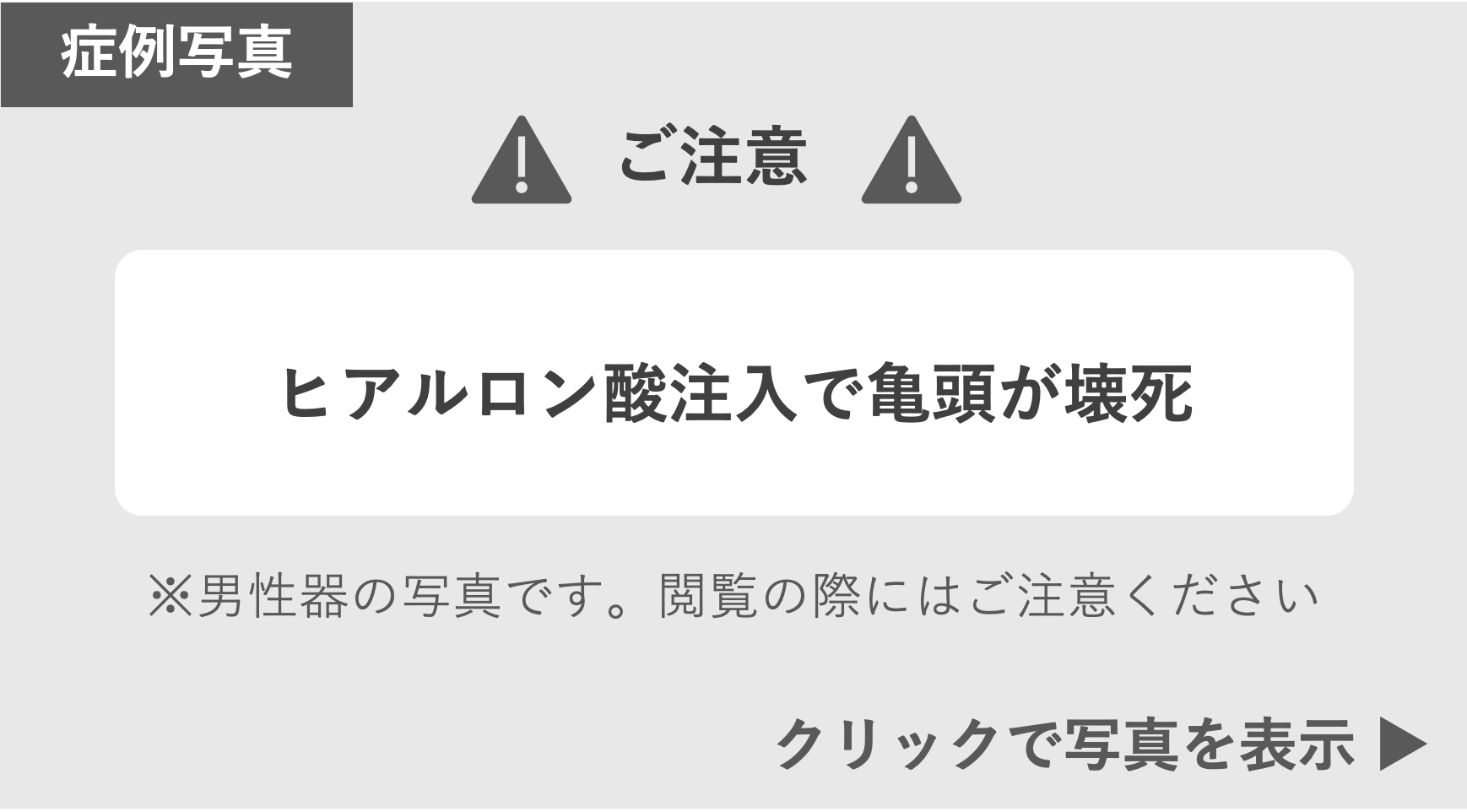 亀頭壊死の症例写真 症例写真閲覧の警告