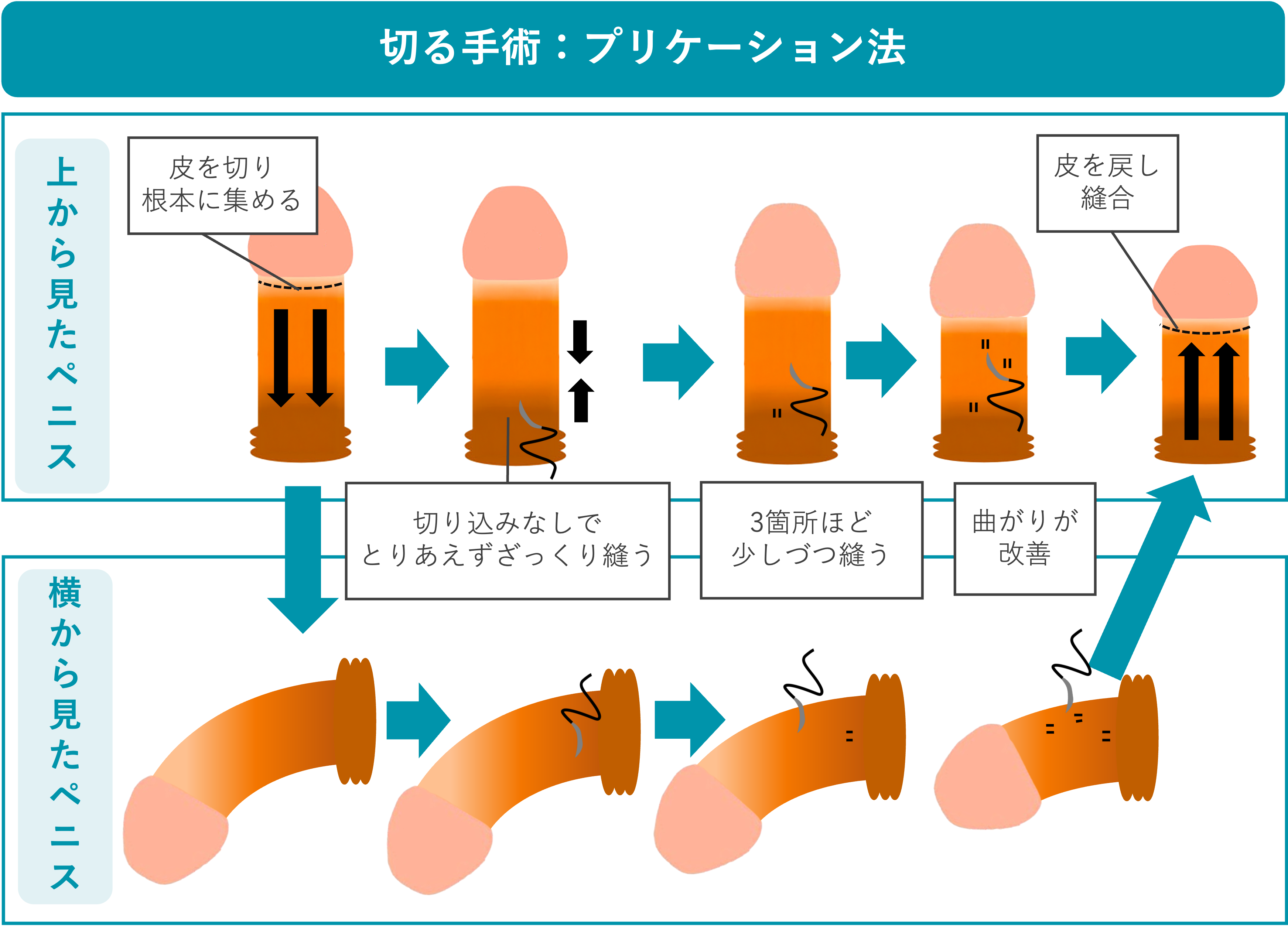 プリケーション法の概要