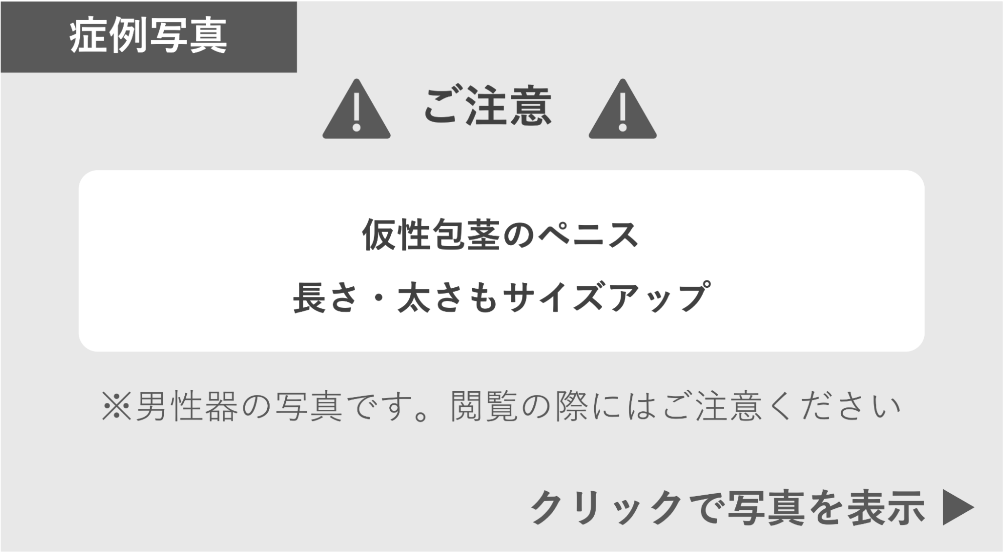 仮性包茎ペニスが長さ太さもサイズアップした症例 症例写真閲覧の警告