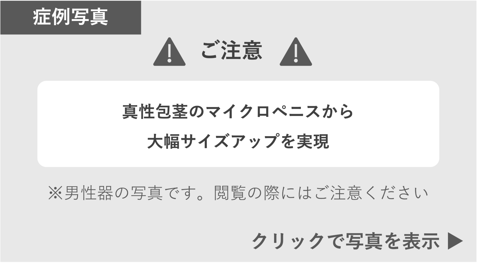 真正包茎のマイクロペニスから大幅サイズアップした症例 症例写真閲覧の警告