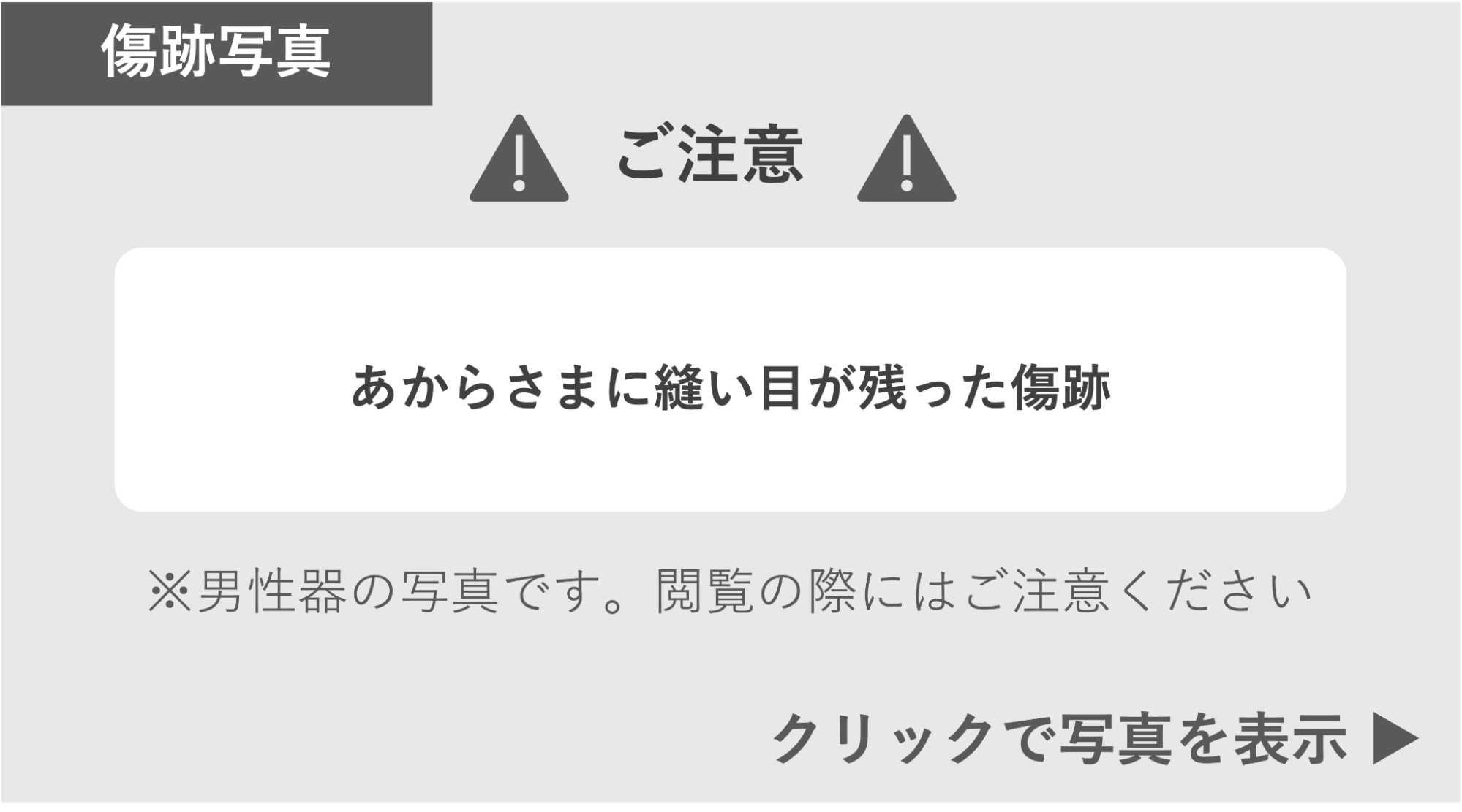 あからさまに縫い目が残った傷跡の症例 症例写真閲覧の警告