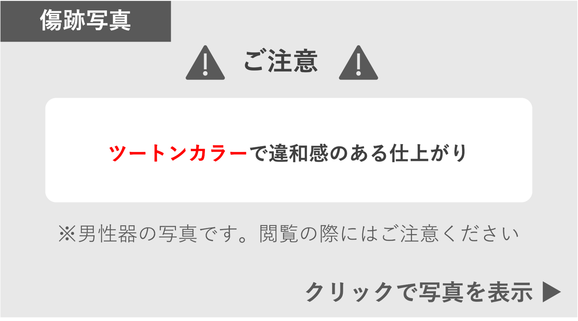 ツートンカラーで違和感が残る症例 症例写真閲覧の警告