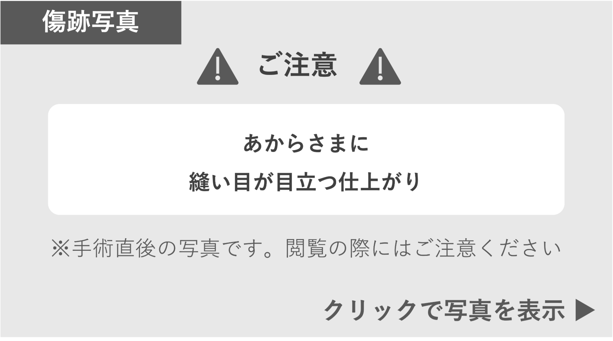 他院手術で縫い目が目立つ仕上がりの症例 症例写真閲覧の警告