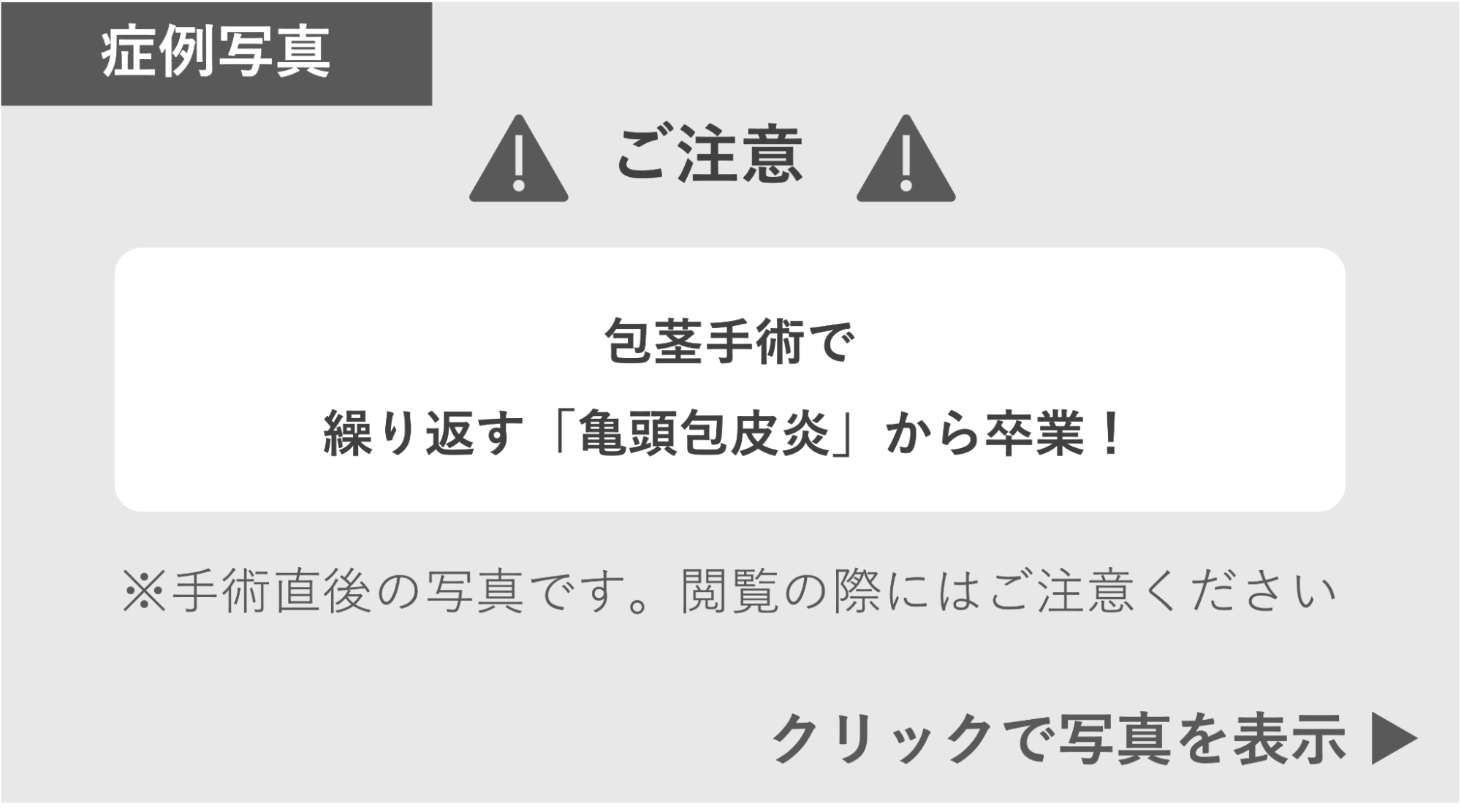 亀頭包皮炎を回避する包茎手術 症例写真閲覧の警告
