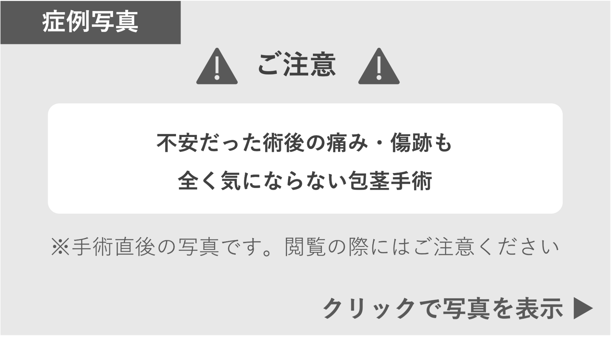 術後の痛み・傷跡が気にならない包茎手術 症例写真閲覧の警告