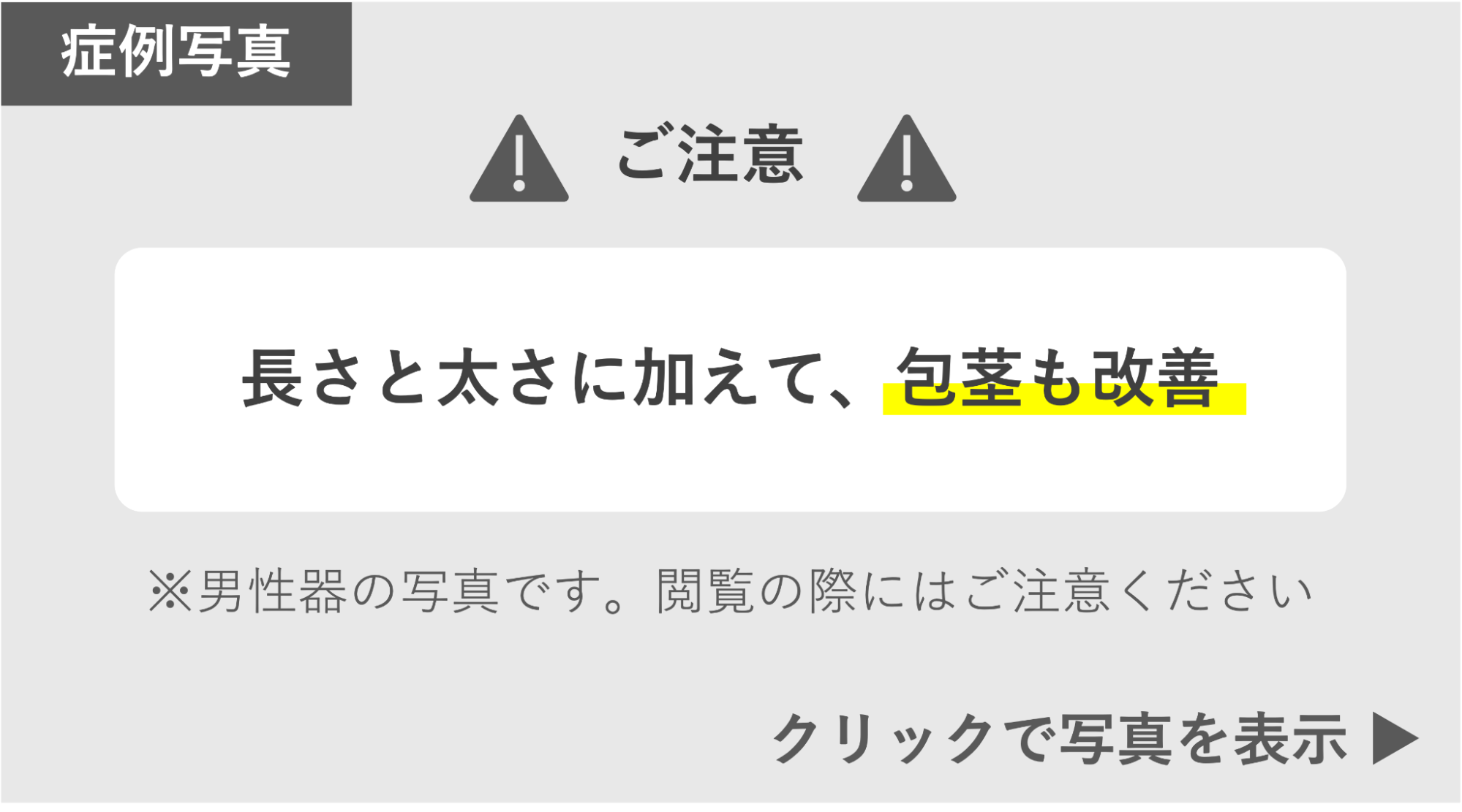 長さ太さに加え、包茎改善の症例 症例写真閲覧の警告