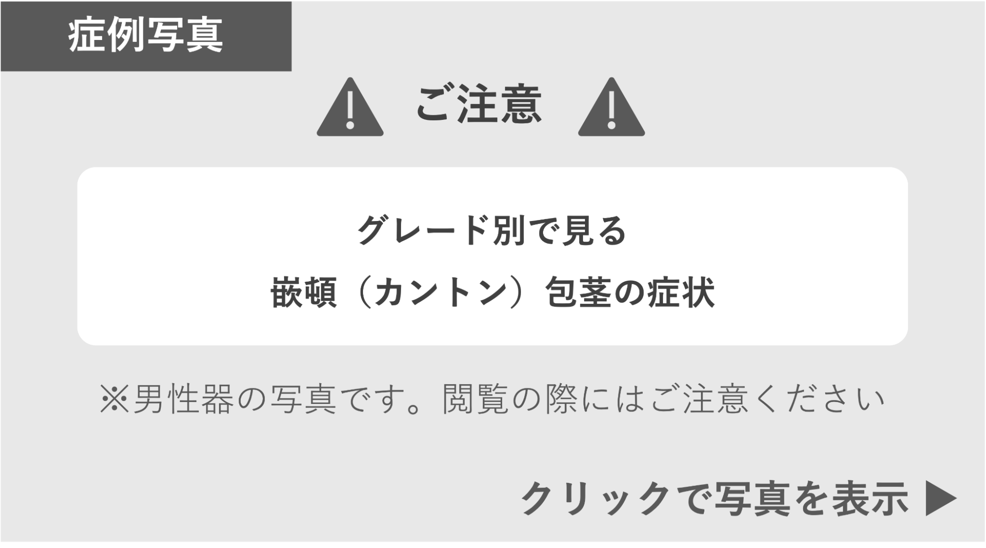 グレード別の嵌頓包茎の症状 症例写真閲覧の警告