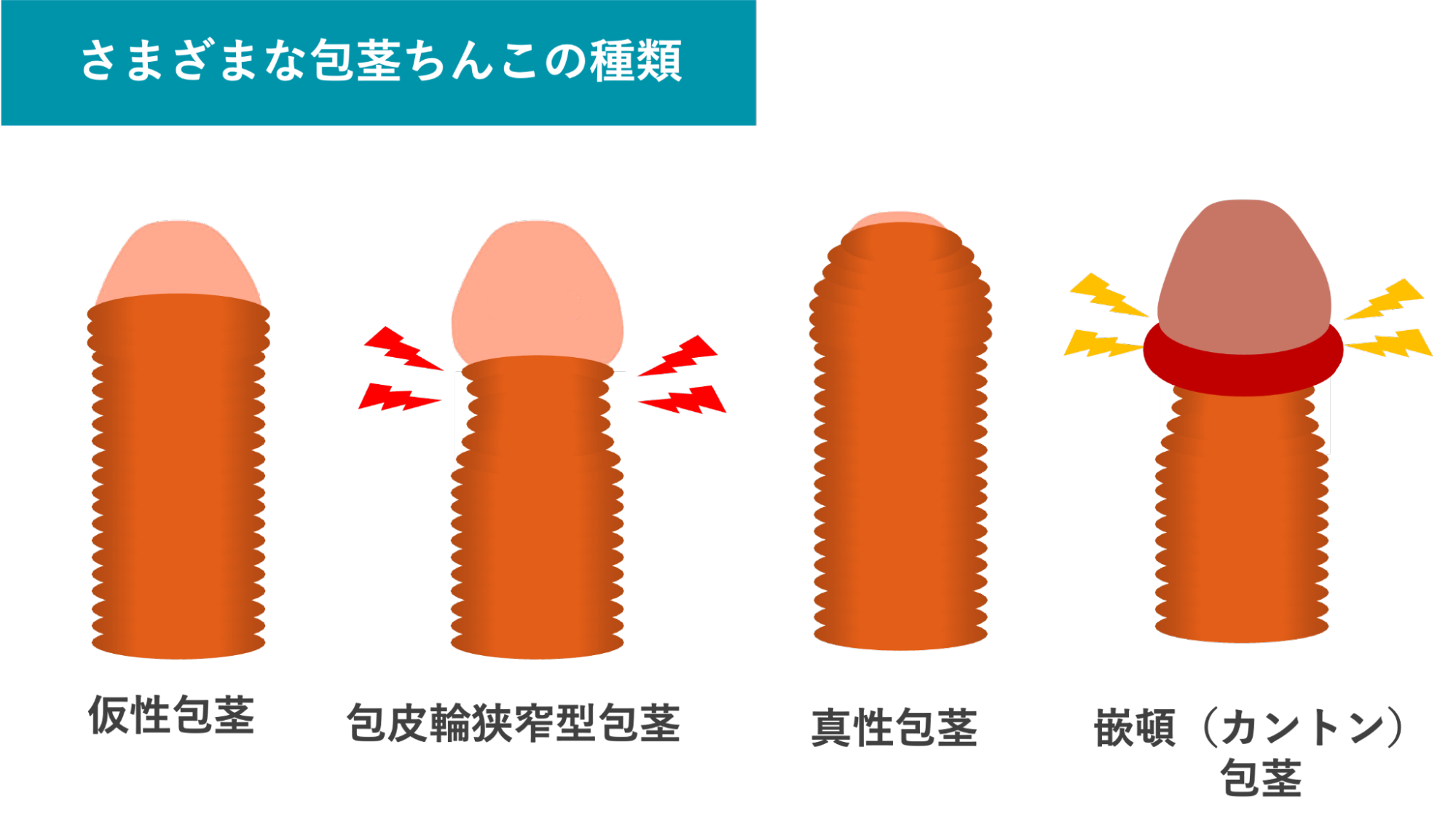 包茎ちんこの種類