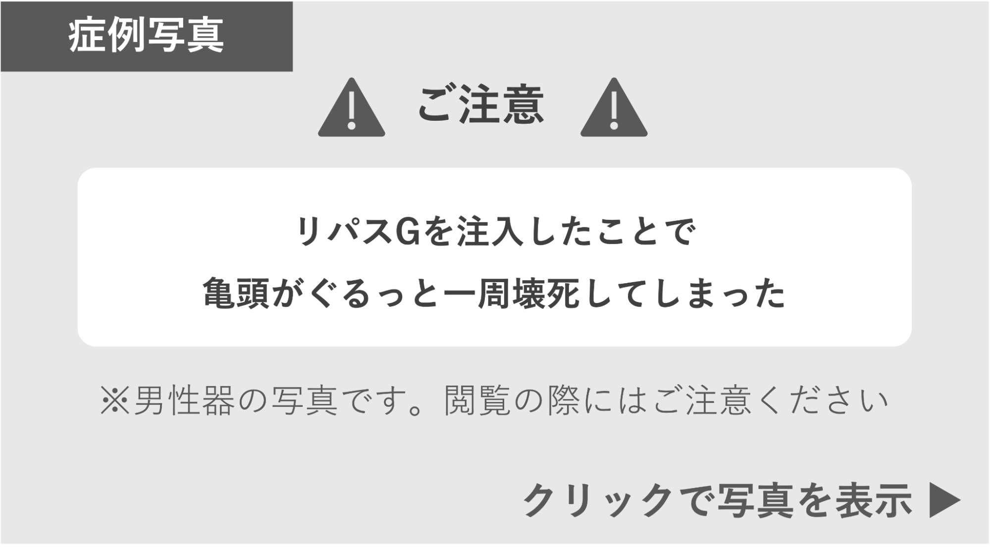 リパスGを注入したことで亀頭が壊死した症例 症例写真閲覧の警告