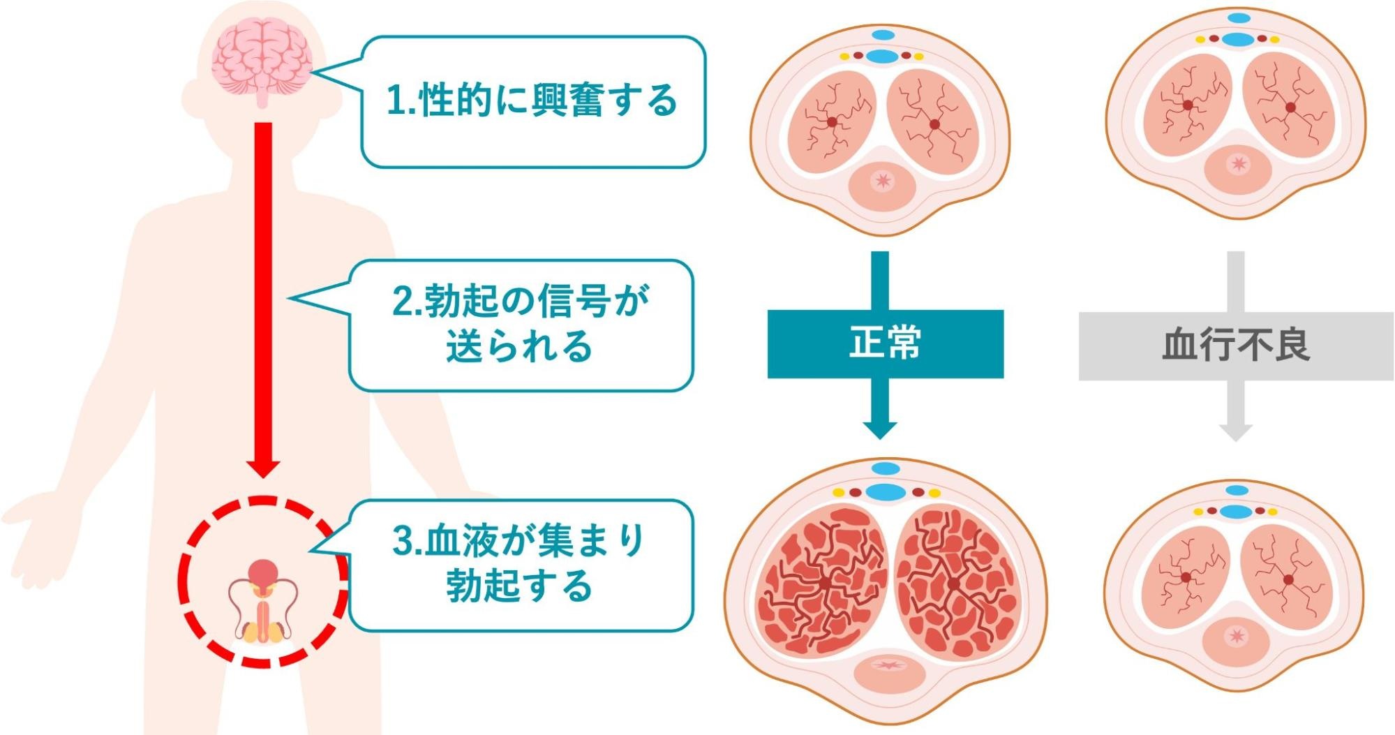 ペニスが勃起する仕組みを説明した図