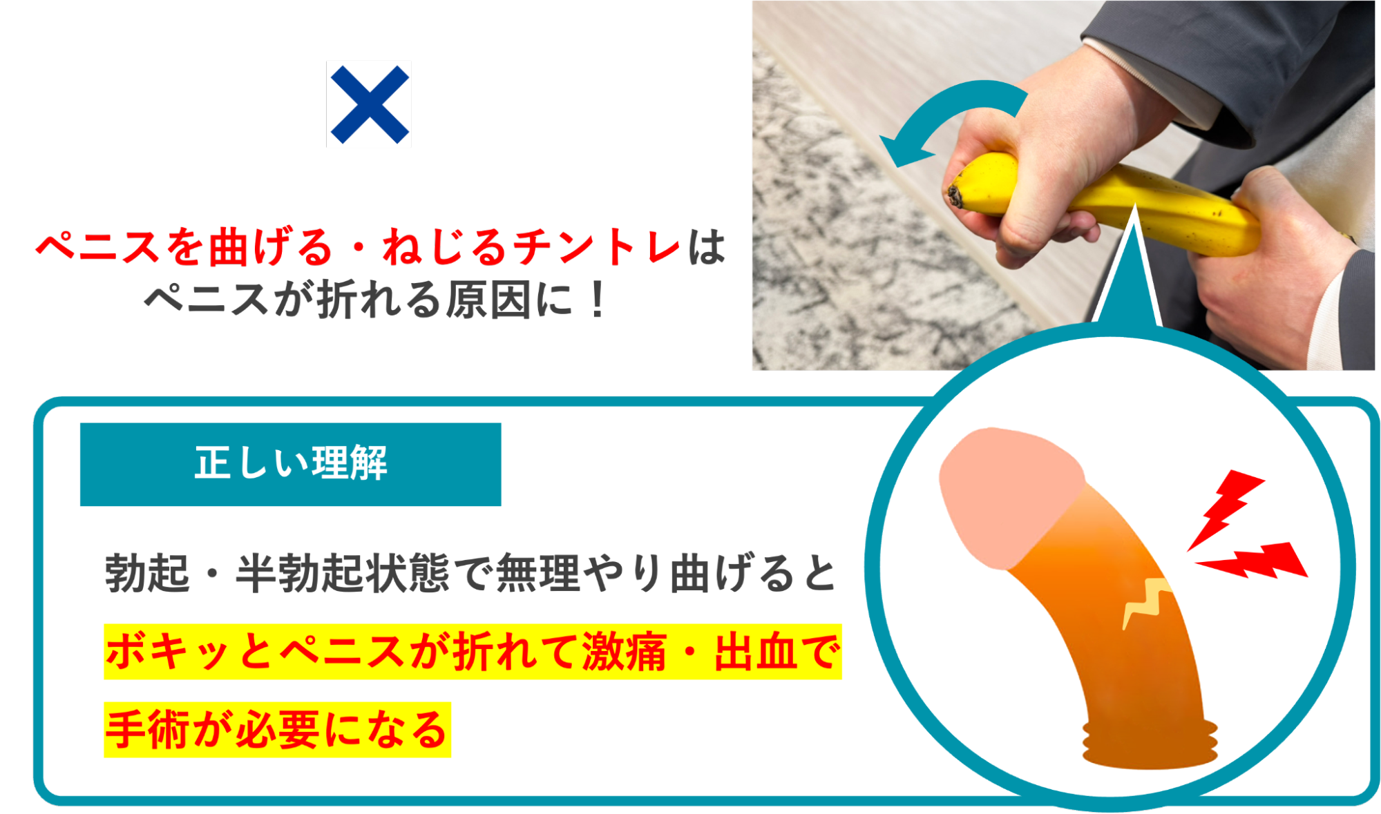 チントレによってペニスが折れる理由の解説