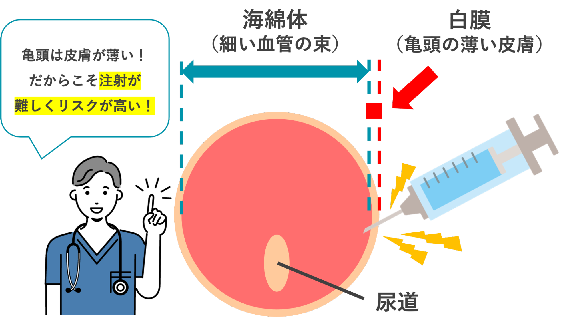 ペニスの断面と皮膚が柔らかいことを表すイメージ
