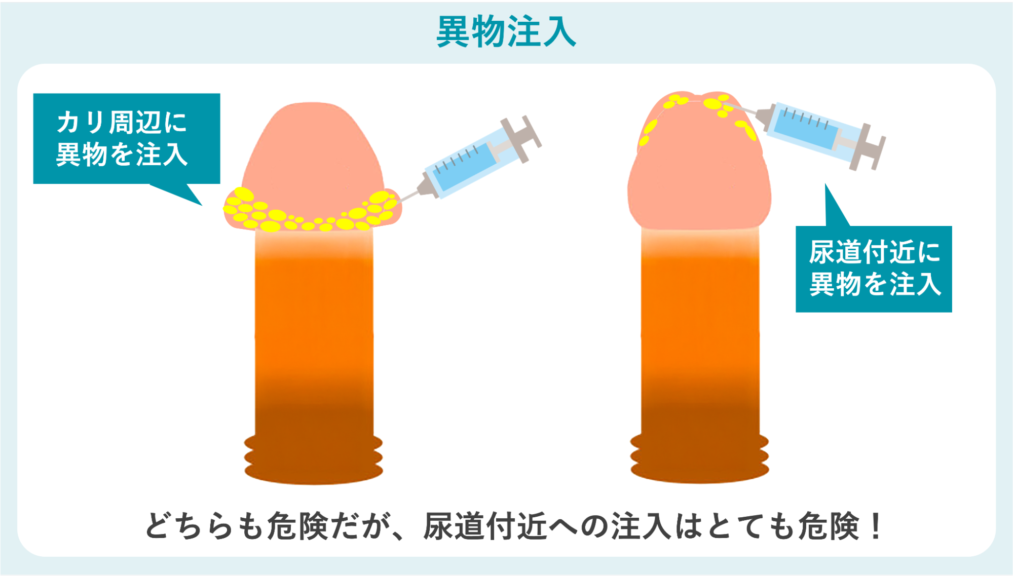 異物注入の危険性を表すイメージ