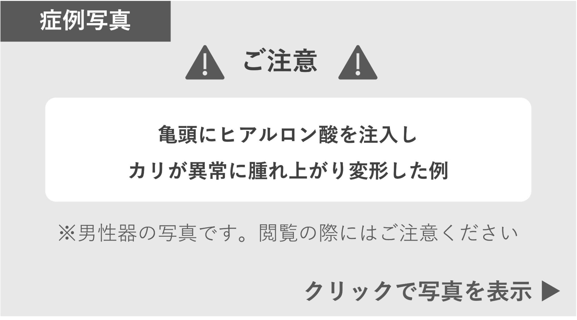 ヒアルロン酸注入でカリ首が異常に腫れ上がり変形した症例 症例写真閲覧の警告