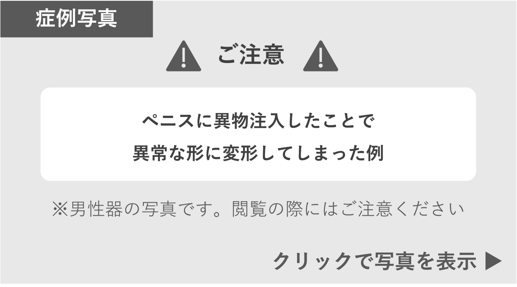 異物注入で異常な形に変形した症例 症例写真閲覧の警告