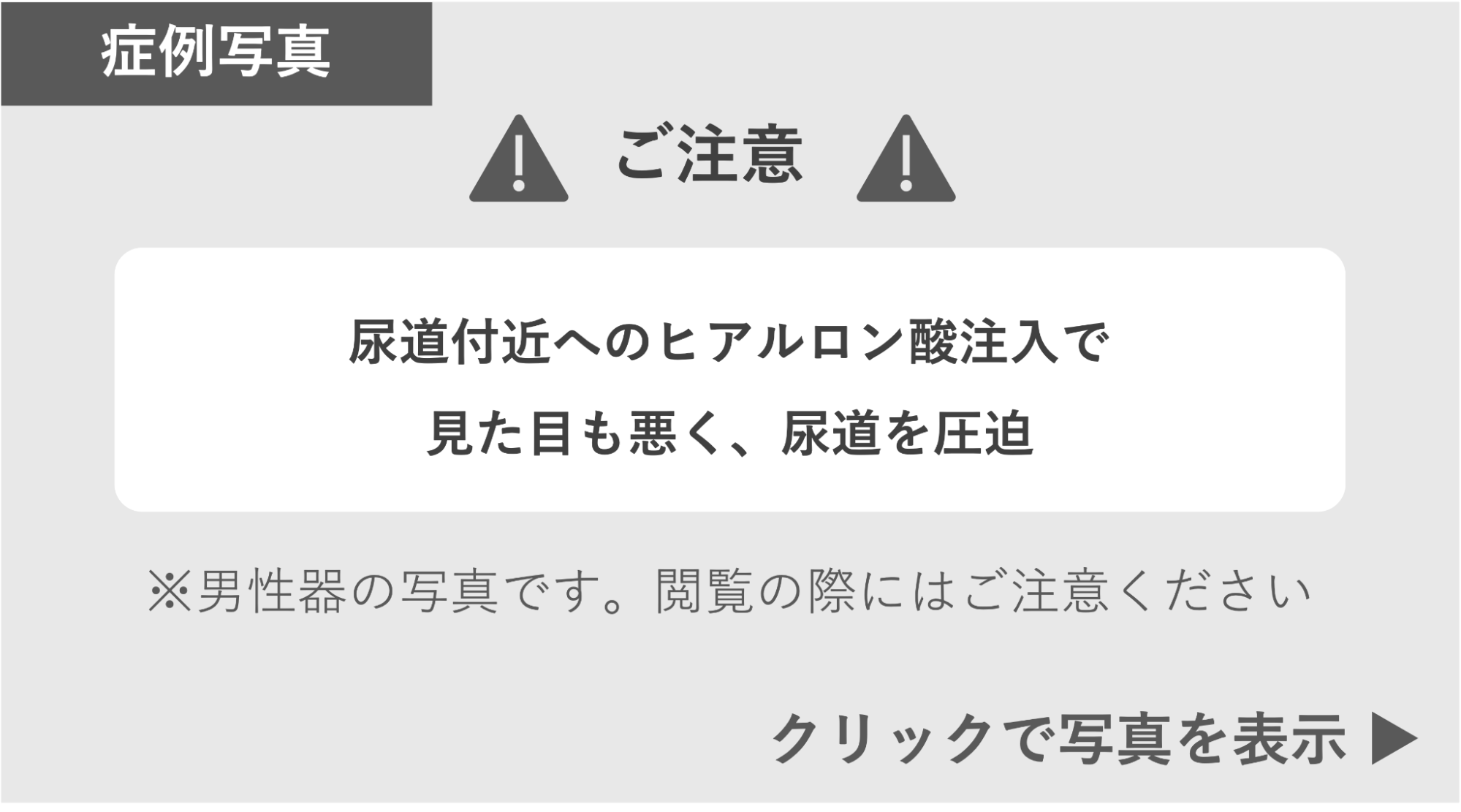 ヒアルロン酸注入で見た目も悪く尿道を圧迫された症例 症例写真閲覧の警告