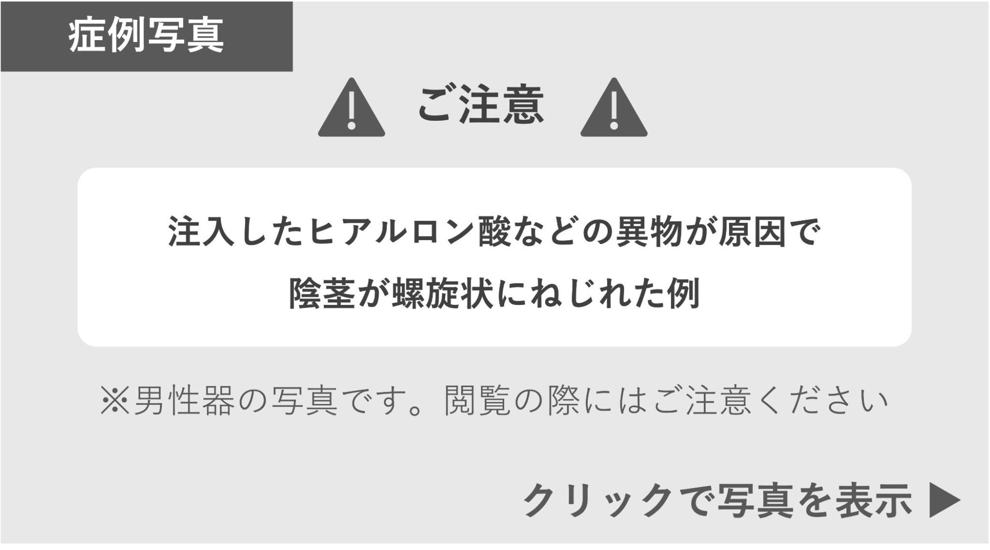 ヒアルロン酸などの異物が原因で螺旋状にねじれた症例 症例写真閲覧の警告