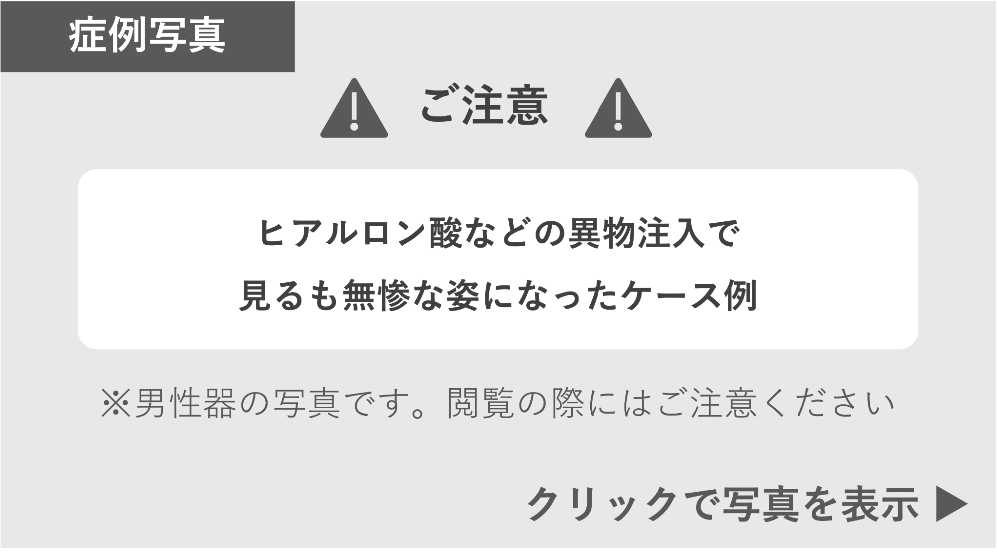 異物注入で見るも無残な姿になったケース 症例写真閲覧の警告