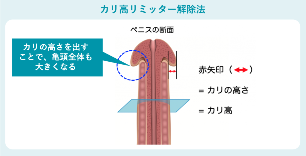 カリ高リミッター解除法の概要