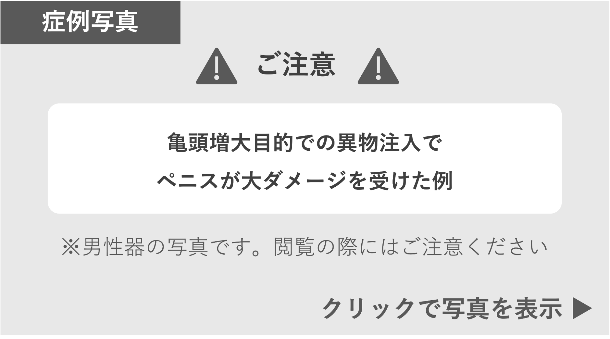 異物注入で大ダメージを受けたペニスの症例写真 症例写真閲覧の警告