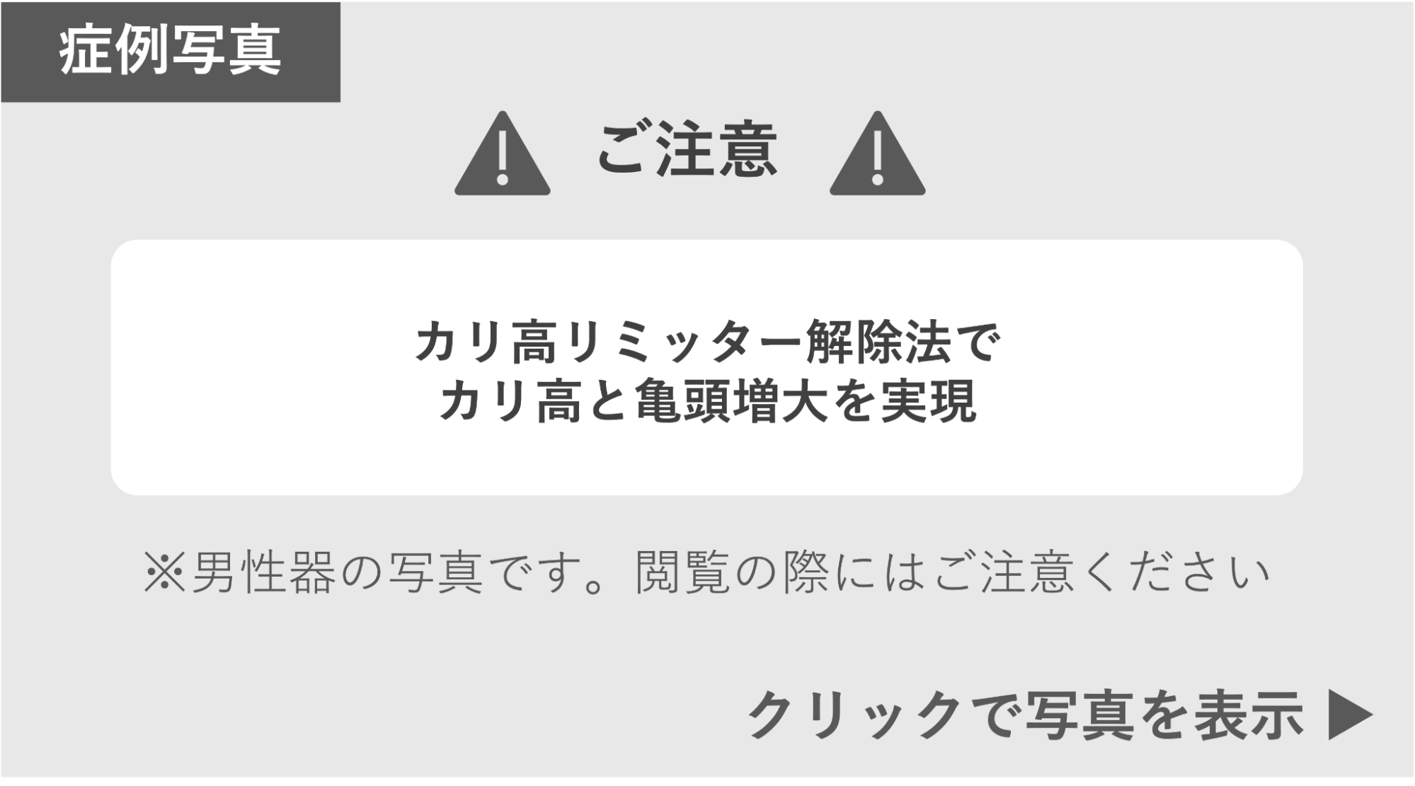 カリ高リミッター解除法を受けたペニスの症例写真 症例写真閲覧の警告