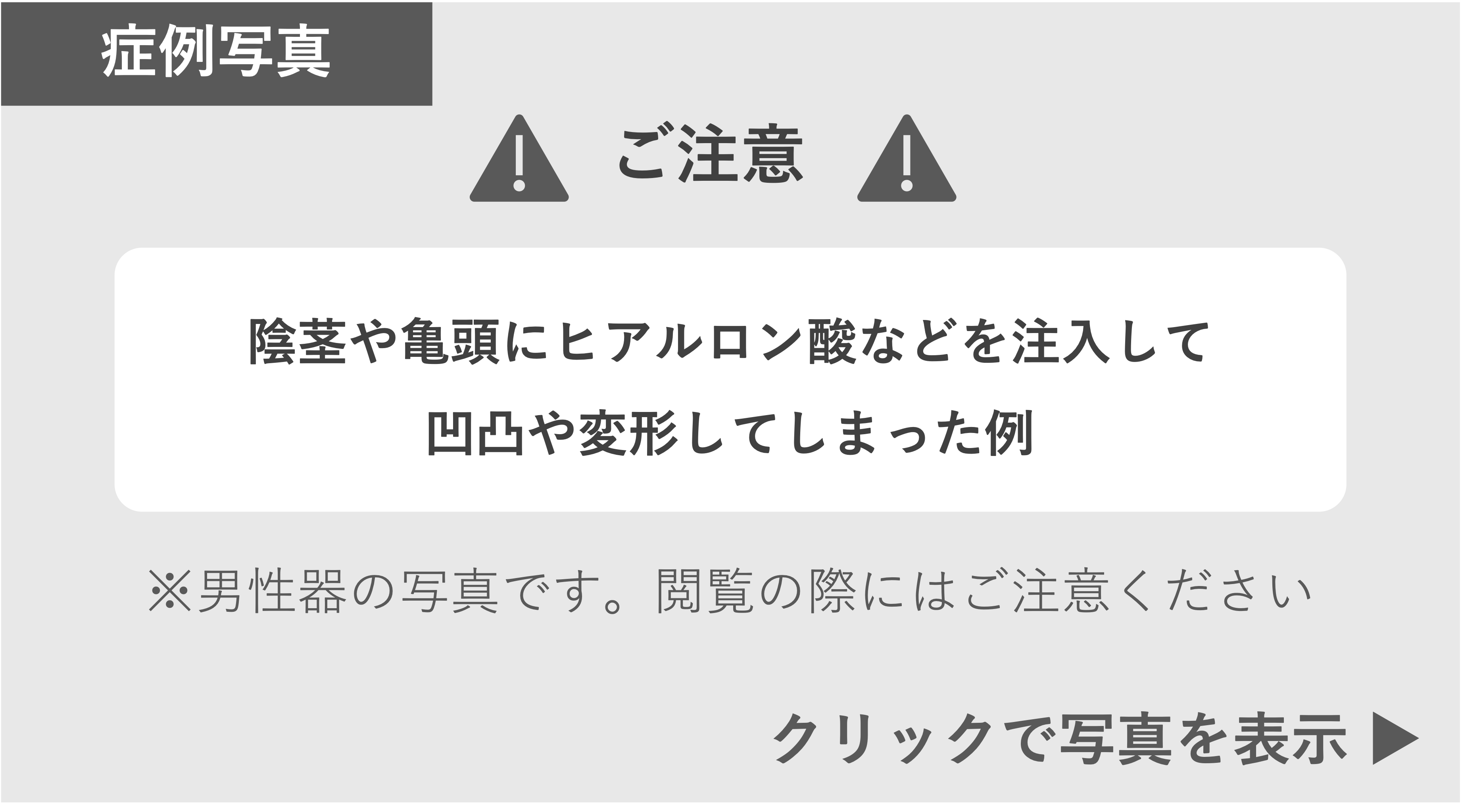 ヒアルロン酸を注入したことで異常な形に変形した症例 症例写真閲覧の警告