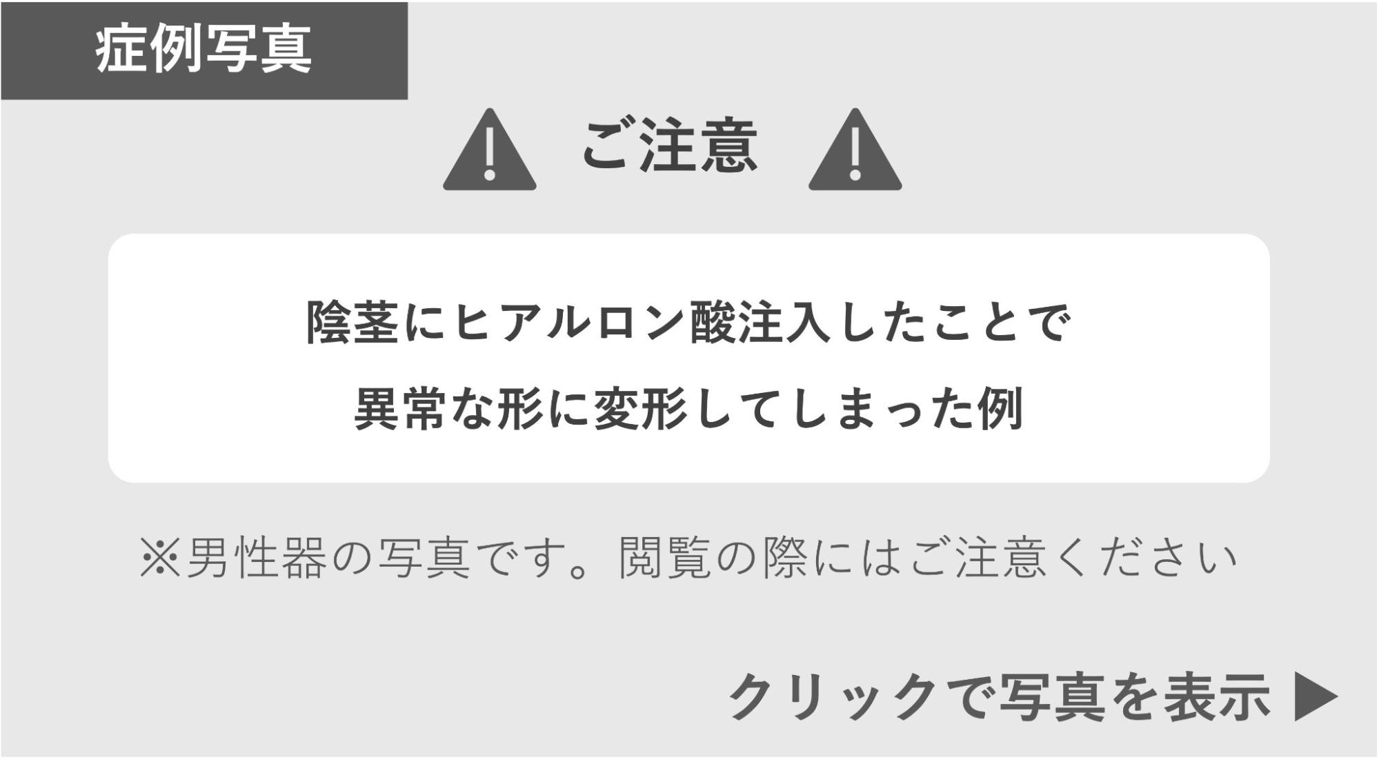 陰茎にヒアルロン酸注入で異常な変更をした症例 症例写真閲覧の警告