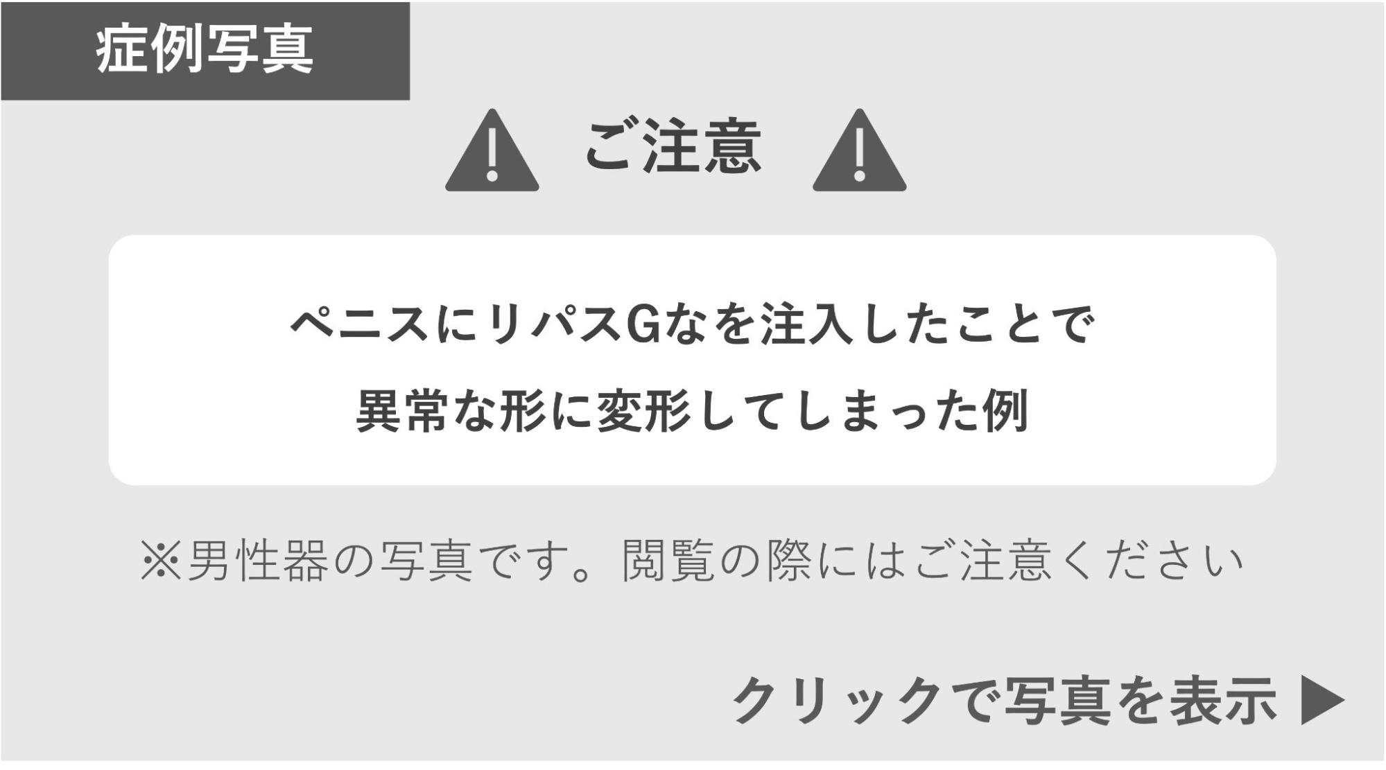 ペニスにリパスGを注入したことで異常な形に変形した症例 症例写真閲覧の警告