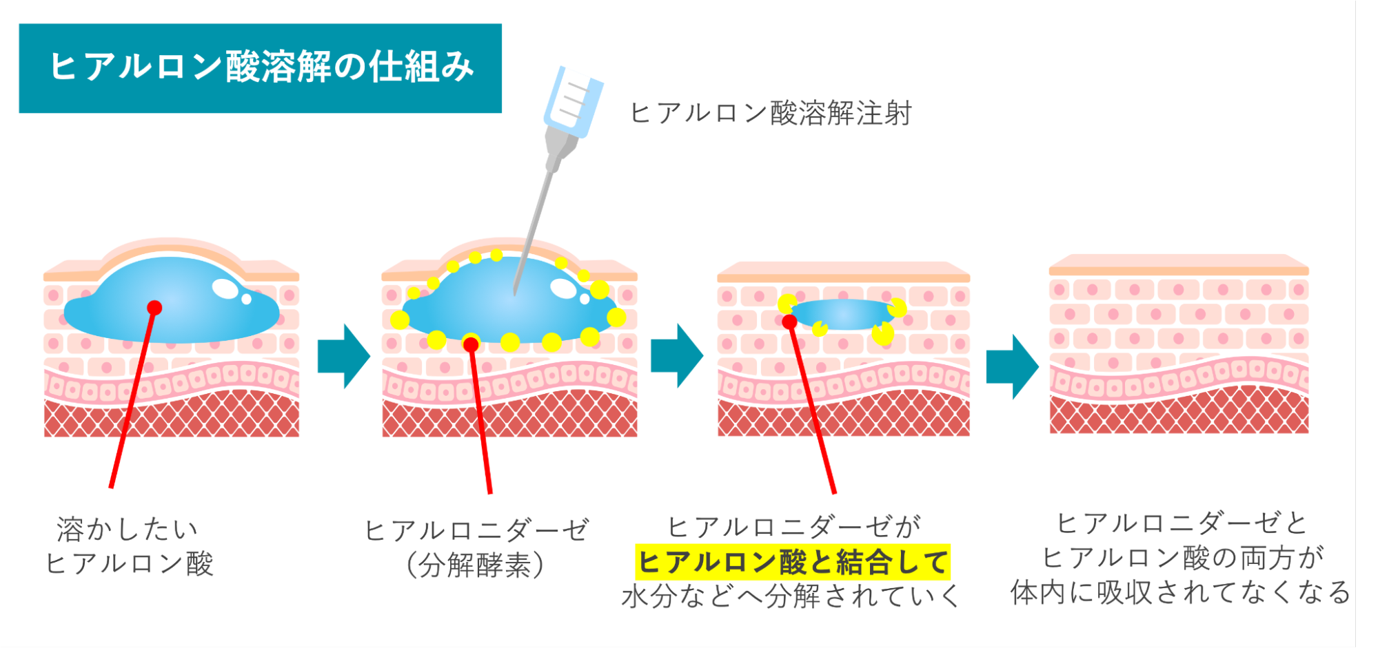 ヒアルロン酸溶解の仕組み