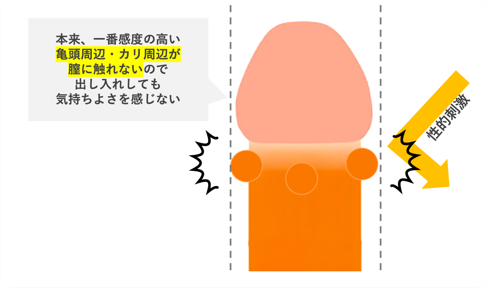 真珠が邪魔になり膣に性的刺激を与えられないイメージ