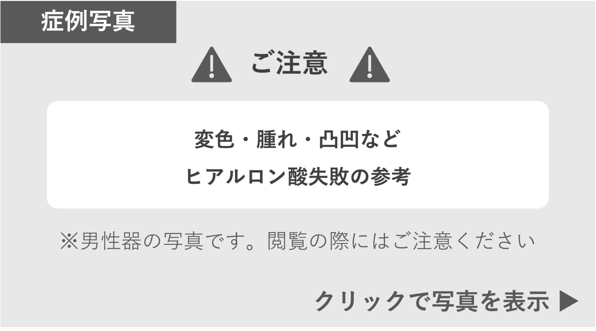 変色・腫れ・おうとつなどのヒアルロン酸失敗症例 症例写真閲覧の警告