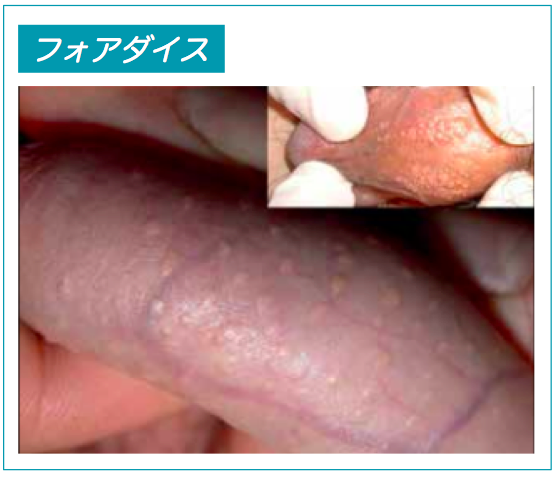 施術写真