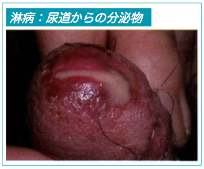 施術写真