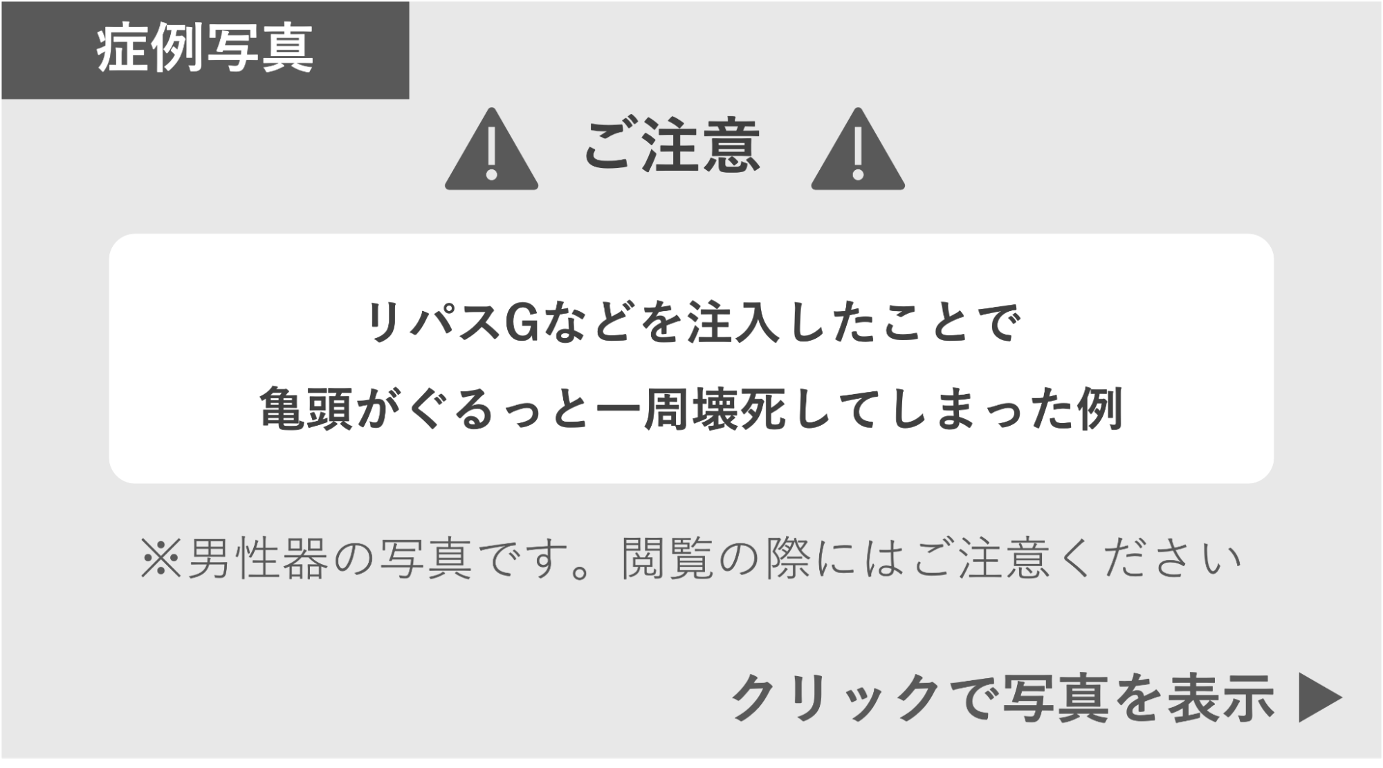 リパスGなどを注入したことで亀頭が壊死した症例 症例写真閲覧の警告