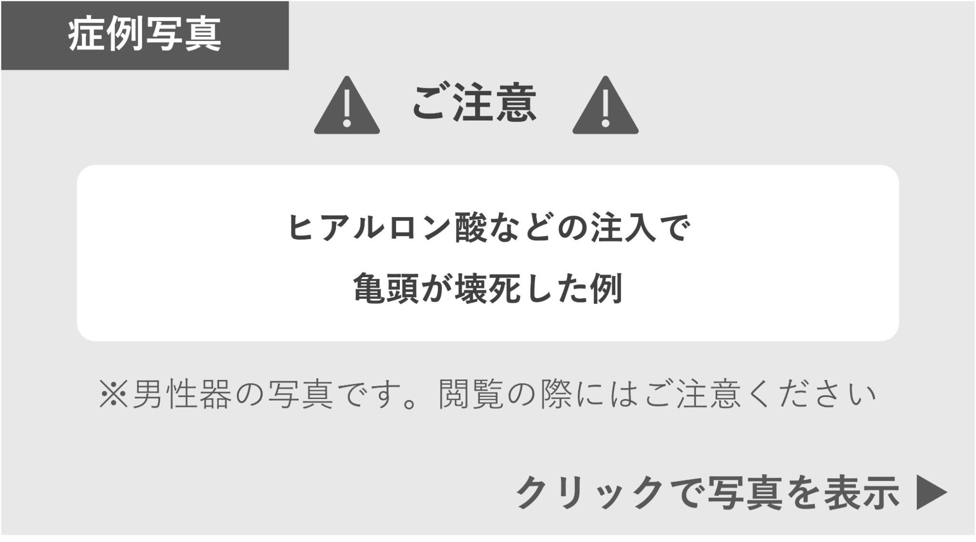 ヒアルロン酸などの注入で亀頭が壊死した症例 症例写真閲覧の警告