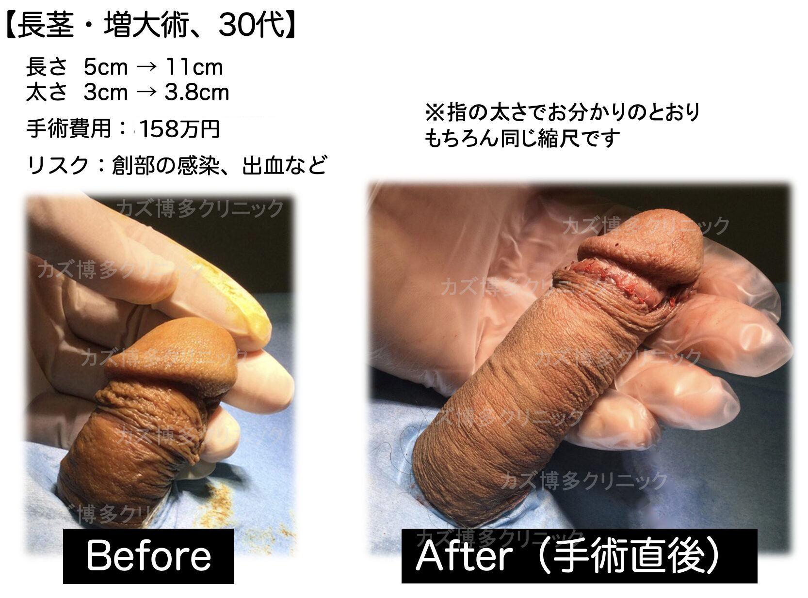 施術写真