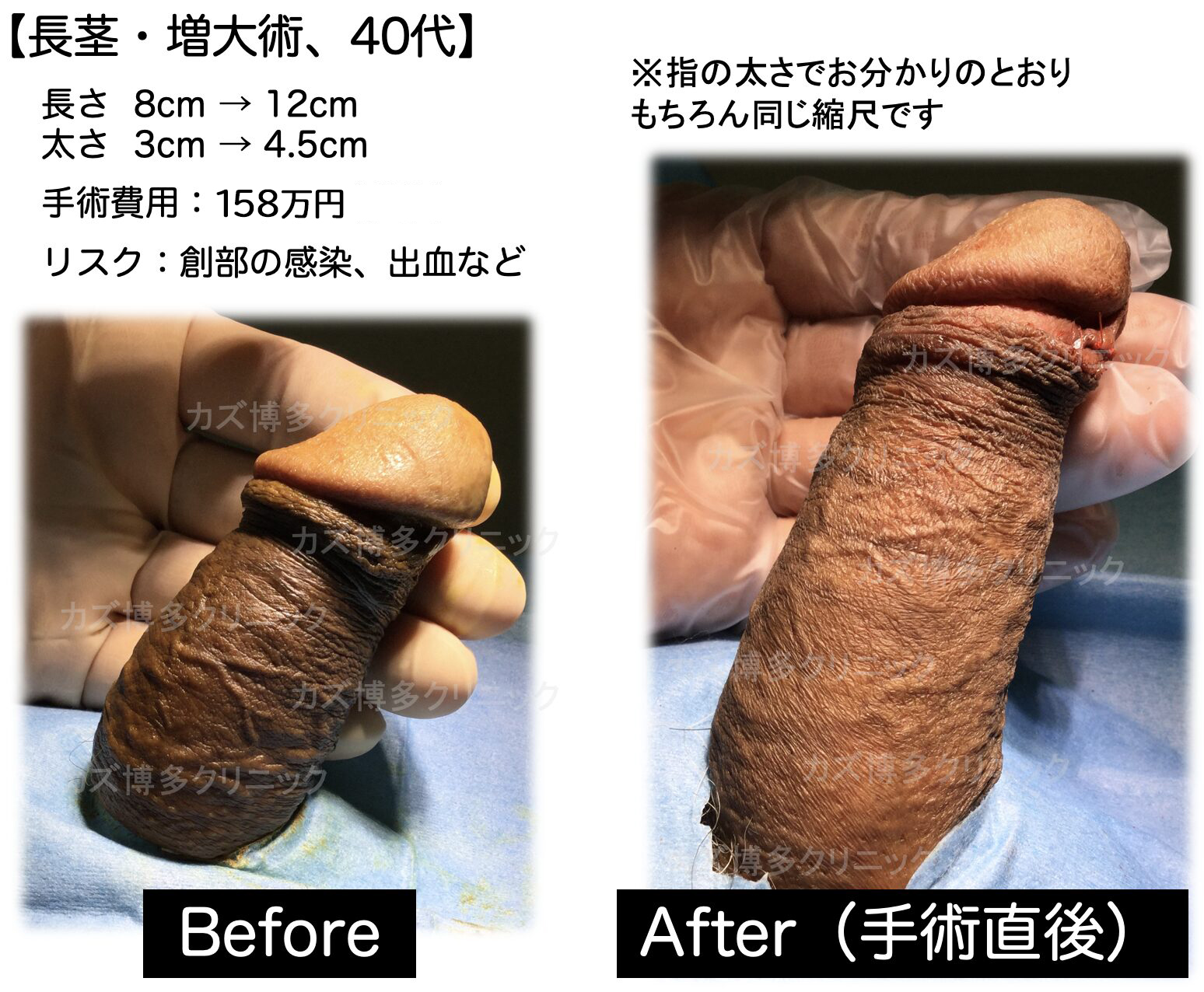 施術写真